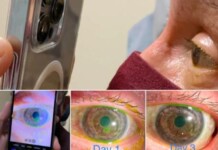 This new feature of iPhone pro max can help doctors in treating eye problems