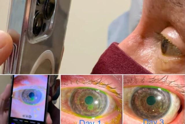 This new feature of iPhone pro max can help doctors in treating eye problems